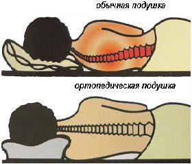 Чи потрібна ортопедична подушка і чи правильно ви на ній спите