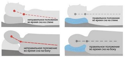 Чи потрібна ортопедична подушка і чи правильно ви на ній спите