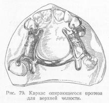 Спираються протези, ортопедична стоматологія