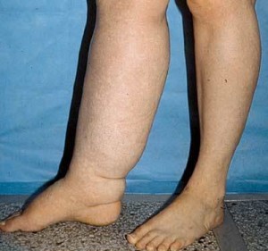 Cauzele cauzelor și consecințelor piciorului