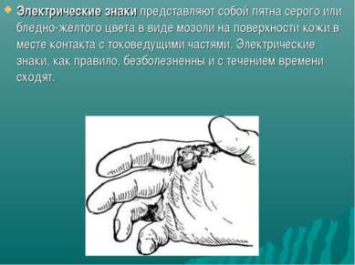 Презентація - дія електричного струму на людину - завантажити безкоштовно