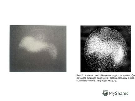 bemutatása az osztály sugárzás diagnosztikai témakör komplex radiális diagnosztikai diffúz