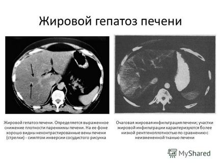 bemutatása az osztály sugárzás diagnosztikai témakör komplex radiális diagnosztikai diffúz