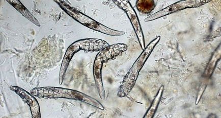 La ce temperatură mizeria demodex piere