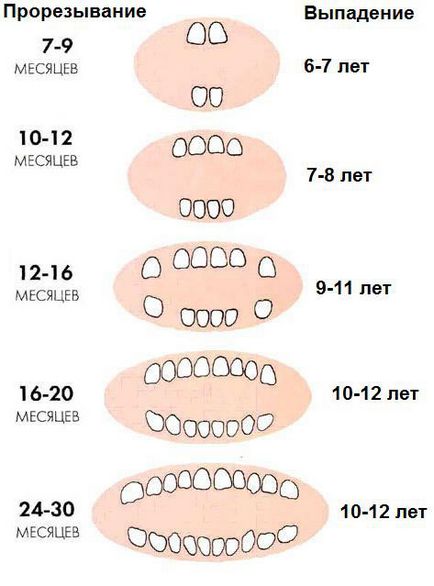 Dentiție dentară la simptomele copiilor, fotografii, gume pentru gingii