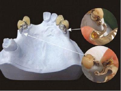 Stomatologia protetică este spitalul stomatologic de stat nr.1, China este cea mai bună stomatologie din România