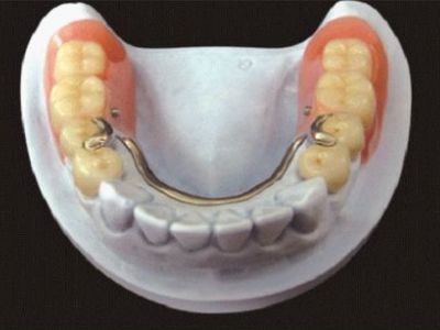 Stomatologia protetică este spitalul stomatologic de stat nr.1, China este cea mai bună stomatologie din România