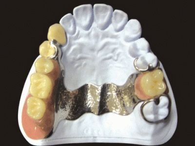 Stomatologia protetică este spitalul stomatologic de stat nr.1, China este cea mai bună stomatologie din România