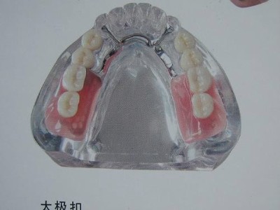 Протезування зубів - державна стоматологічна лікарня №1, китай - найкраща стоматологія в