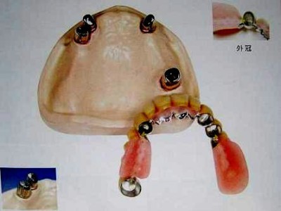 Stomatologia protetică este spitalul stomatologic de stat nr.1, China este cea mai bună stomatologie din România