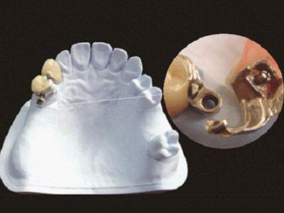 Stomatologia protetică este spitalul stomatologic de stat nr.1, China este cea mai bună stomatologie din România