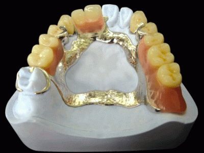 Протези - членка Dental болница №1, Китай - най-добрият стоматология