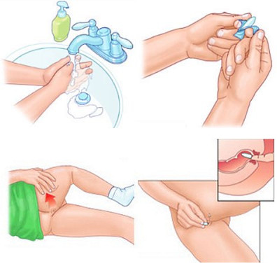 Recipiente de metacluracil rectal