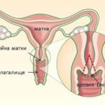 Desene pe unghii - un jurnal medical popular