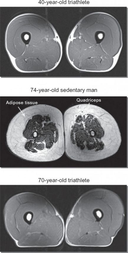 Sarcopenia mai veche, cu atât mai important este formarea