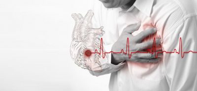 Скільки живуть люди після обширного інфаркту