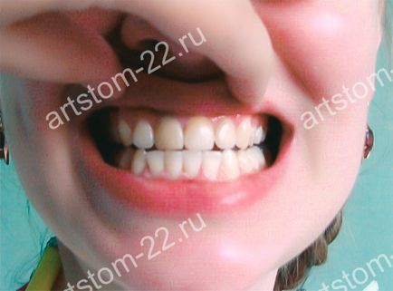 Clinica stomatologica art-stoma, tratament dentar in barnaul