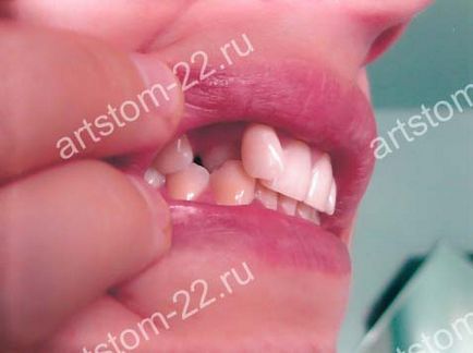 Clinica stomatologica art-stoma, tratament dentar in barnaul