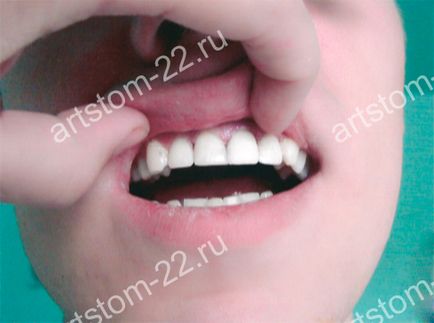 Clinica stomatologica art-stoma, tratament dentar in barnaul