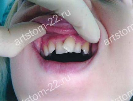 Clinica stomatologica art-stoma, tratament dentar in barnaul