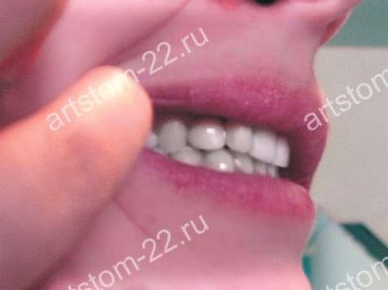 Clinica stomatologica art-stoma, tratament dentar in barnaul