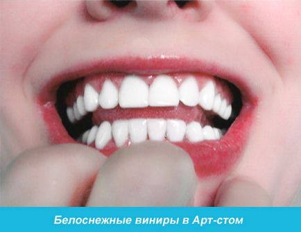 Clinica stomatologica art-stoma, tratament dentar in barnaul