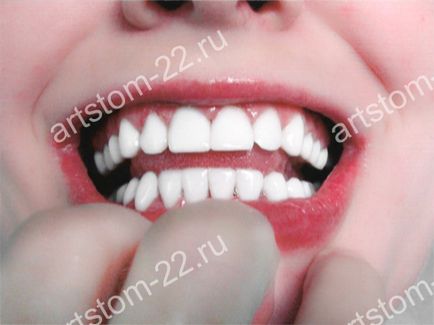 Clinica stomatologica art-stoma, tratament dentar in barnaul