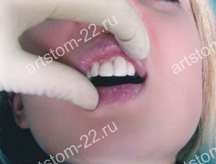 Clinica stomatologica art-stoma, tratament dentar in barnaul