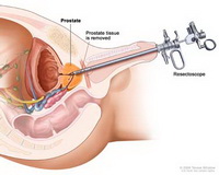 Sucursala Sverdlovsk a Societatii de Urologi din Rusia - departamentul urologic №3