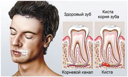 Температура після видалення зуба причини і як збити