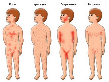 Temperatura sugarului 2 luni 37 trebuie să o reducă