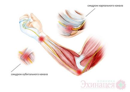 Узі периферичних нервів (узі серединного нерва, узі сідничного нерва) клініка ехінацея Київ