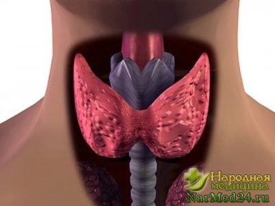Clasificarea nodulară a gâtului, obiceiurile alimentare, medicina populară