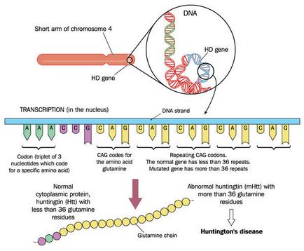 Chorea Huntington, simptome și tratament, modalități de diagnosticare