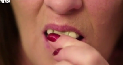 Un rezident al Angliei și-a lipit dinții pe superglue timp de 10 ani - stomatologie - știri