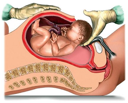 АГ класификация кръвоизлив и спешна медицинска помощ