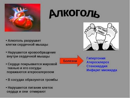 Alcoolul pentru afecțiunile circulatorii ale creierului și modul în care acesta afectează