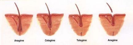 Alopecia androgena la bărbați - cauze, simptome, tratament