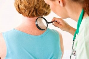 Simptomele dermatitei atopice sau alergice la adulți