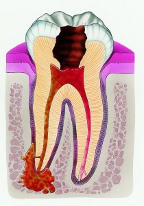 Doar doare să mușcă dinte - portalul medical, totul despre sănătatea umană