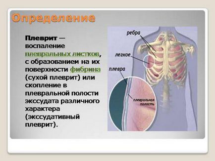 Tulburări pulmonare cu tuse, dureri în piept severe cu respirație profundă, drept, copil și adult,