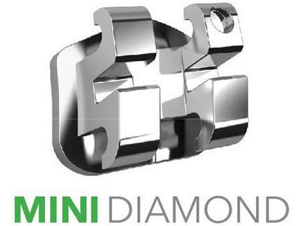 Брекети mini diamond особливості та переваги системи