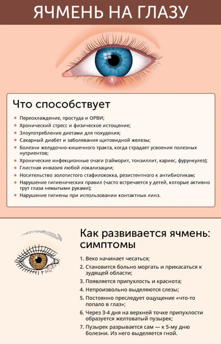 Чим лікують ячмінь на оці у дорослого причини появи і лікування народними засобами, внутрішній