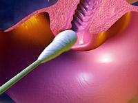 Citologie a colului uterin