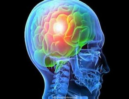A diagnózis epilepszia, agyi rendellenesség