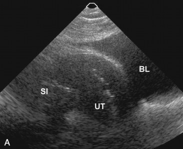 Diverticuloza și diverticulita în uzi (prelegere pe diagnostician)