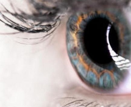 Ectopia subluxării și luxației lentilelor