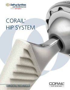 Endoprosthesis corail caracteristici structurale și metode de aplicare