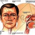 sinusitis tünetei