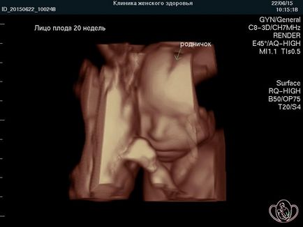 Unde să faceți uzi în Pyatigorsk, o clinică de stațiune pentru sănătatea femeilor